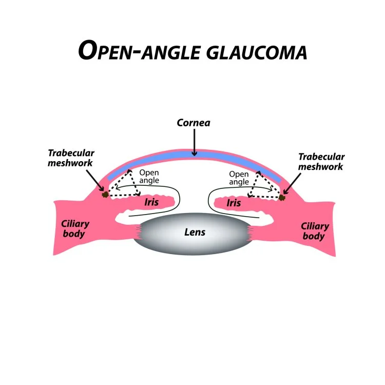 Open Angle Glaucoma Market Size : Epidemiology, Industry Trends, Opportunity and Forecast till 2024-2034